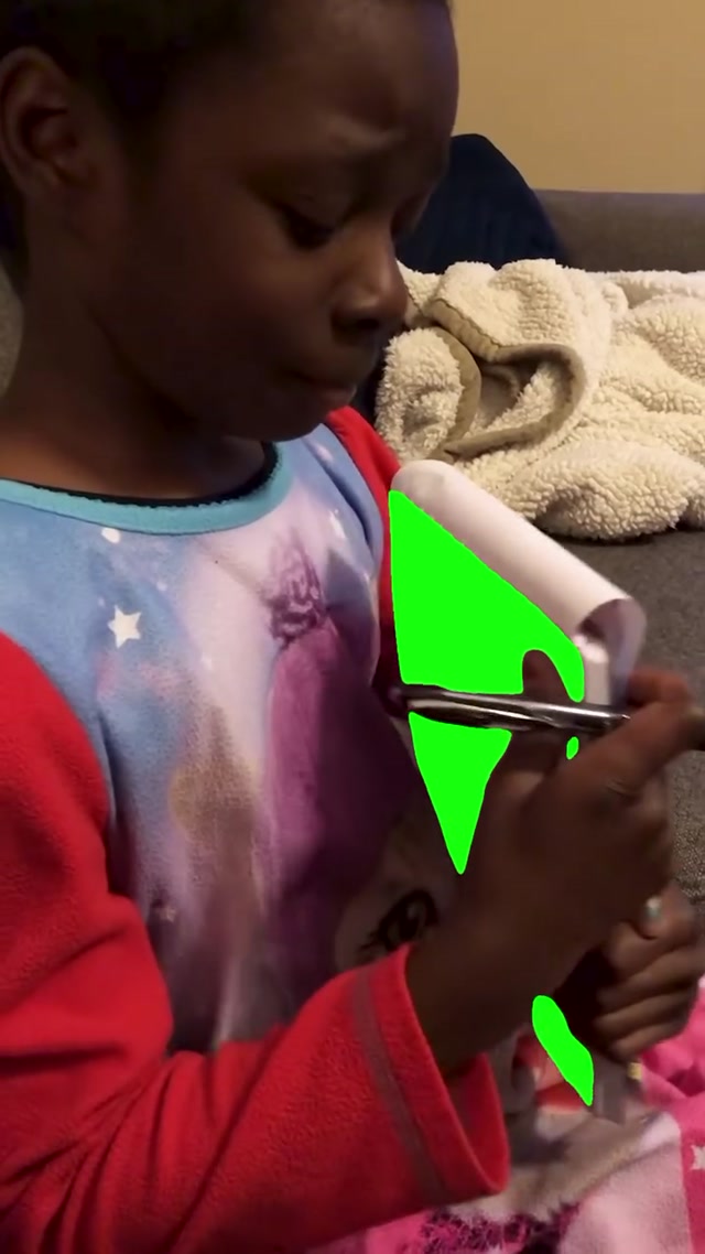 Hyperpigmentation meme template blank