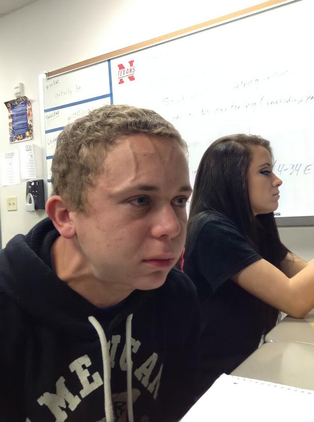 The Forehead Vein Guy meme template blank