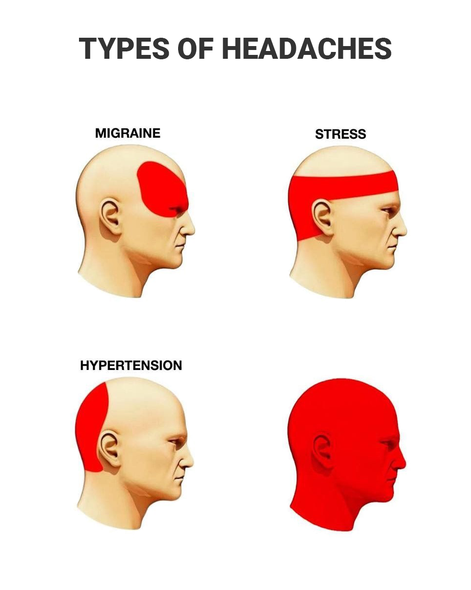 Types of Headache meme template blank - image format